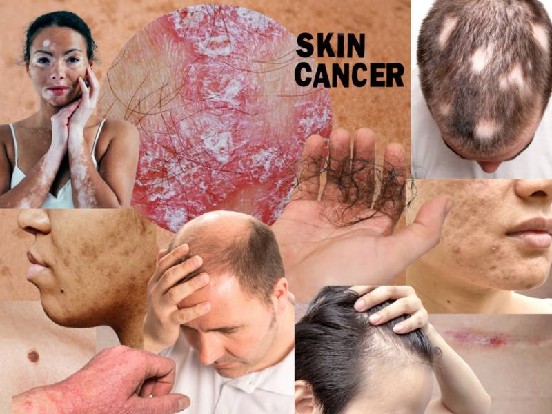 Dra. atención dermatología en Querétaro