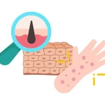 Teconoogia adecuada en dermatologia en queretaro